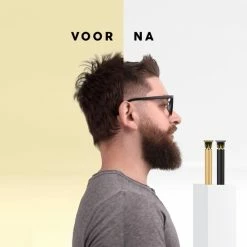 VRL Tondeuse ? Trimmer Voor Mannen ? Baard ? Haartrimmer ? Tondeuse Mannen Hoofdhaar ? 0 Tot 9 Millimeter -Philips winkel 550x550 565